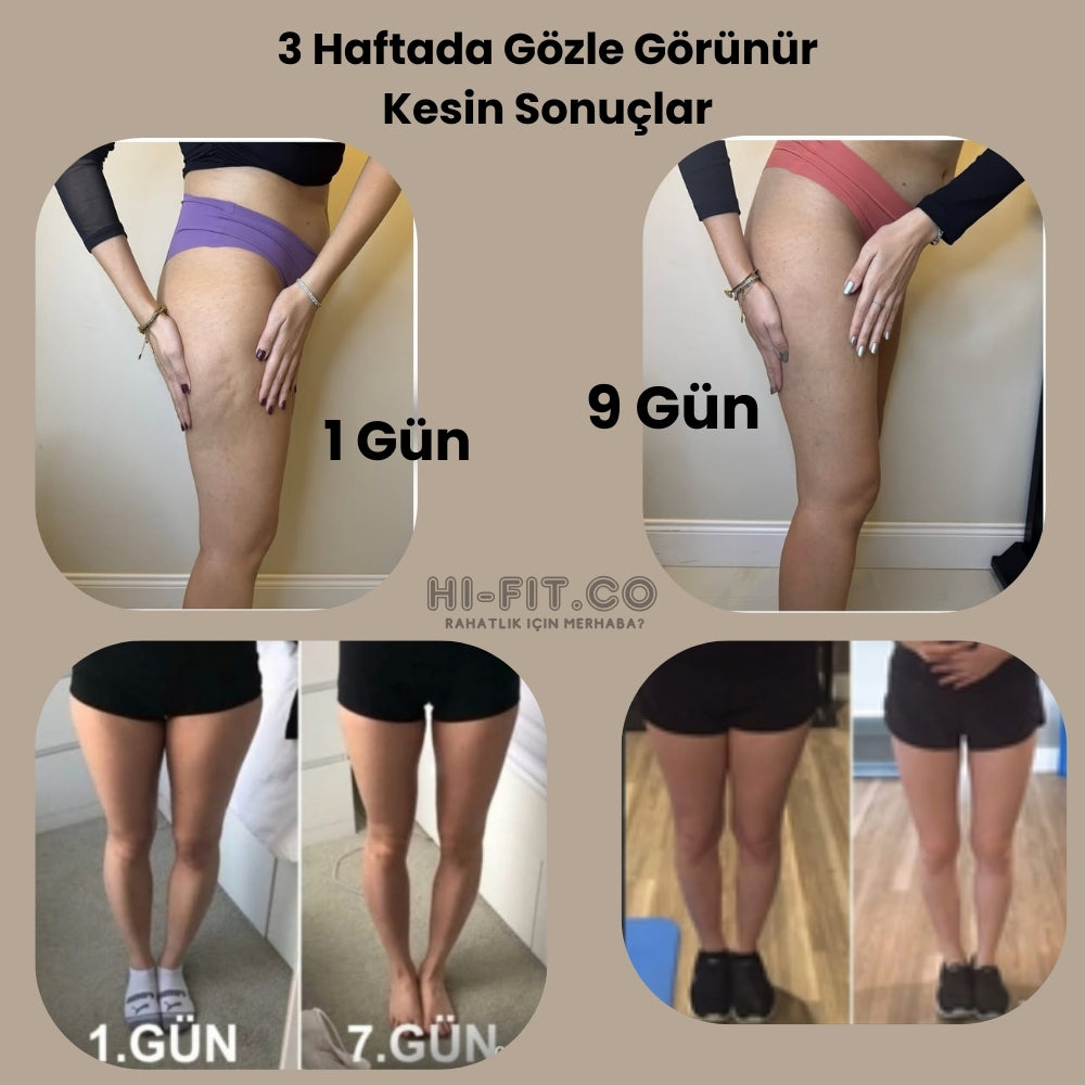 Hi-Fit Bacak Sıkılaştıran  Masaj Aleti